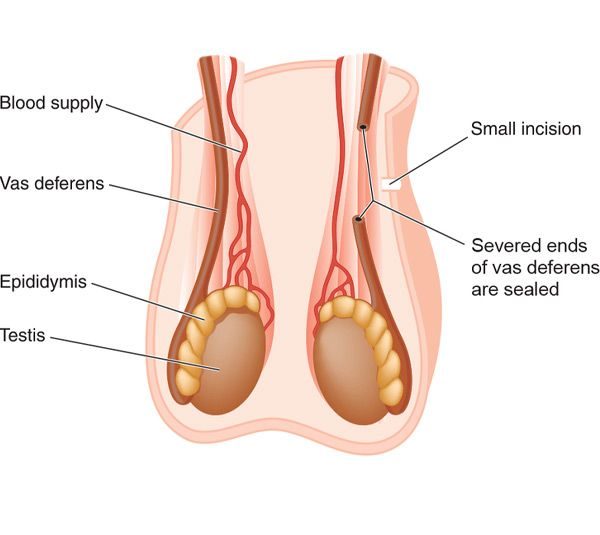 diagram of the male reproductive system